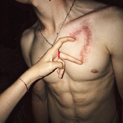GRANT